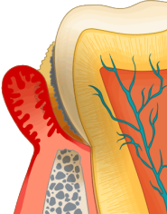 �����|�P�b�g